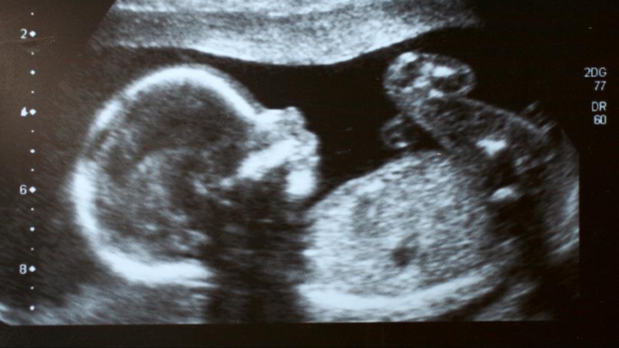 APD : les données à caractère personnel d’un enfant à naître sont également protégées
