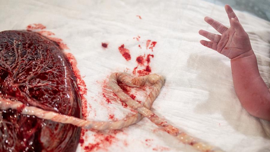 Eiwit TRPV2 essentieel in de ontwikkeling van de placenta