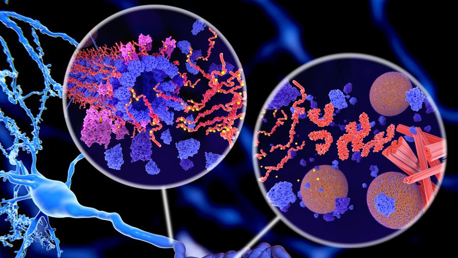 Biomarkerbloedtest bij alzheimerdiagnose: voordelen en beperking