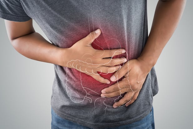 Syndrome du côlon irritable: aperçu thérapeutique