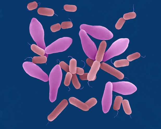 Belgische wetenschappers ontdekken hoe specifieke E. coli-bacteriën darmkanker veroorzaken