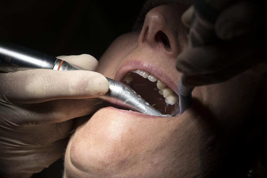 Un jeune Belge sur trois reporte sa visite chez le dentiste pour des raisons financières