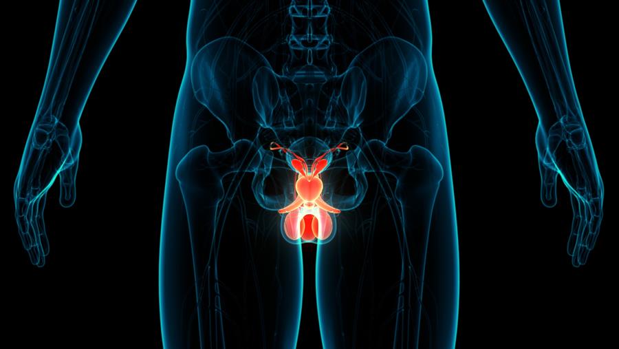Teelbalkanker: een biomarker voor opsporing van recidief