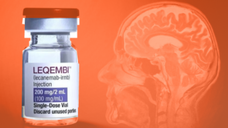 Geen terugbetaling van Alzheimer-medicijn Leqembi
