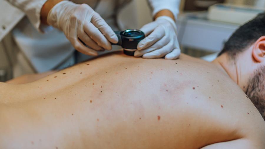 Cancers cutanés : vers une médecine plus personnalisée, plus précoce, plus ciblée
