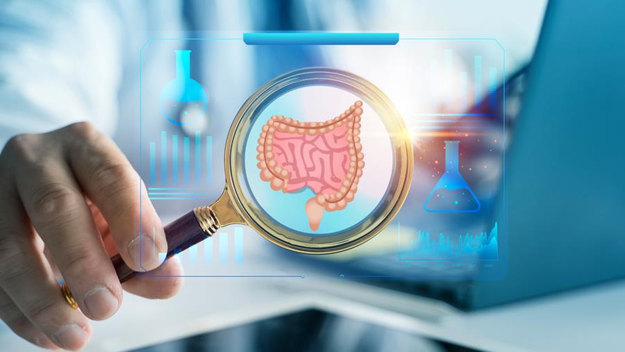 Cancer colorectal : l’ère du traitement moléculairement sélectionné